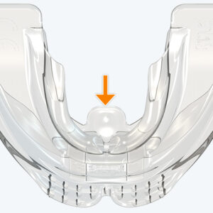MRC myOSA TMJ-BDS S3 Non-Mouldable