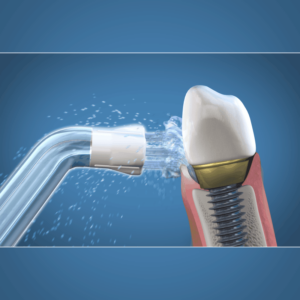 Waterpik PS Plaque Seeker otsik 2tk