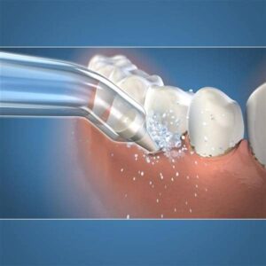 Waterpik otsik Pik Pocket 2tk