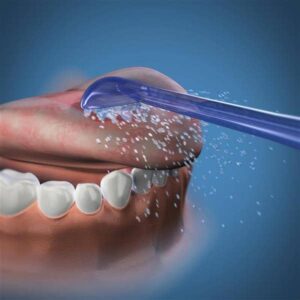Waterpik keelekaabits 2tk