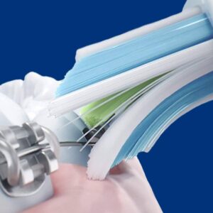 Philips Sonicare ProtectiveClean 4500
