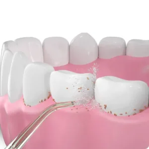 Oclean N10